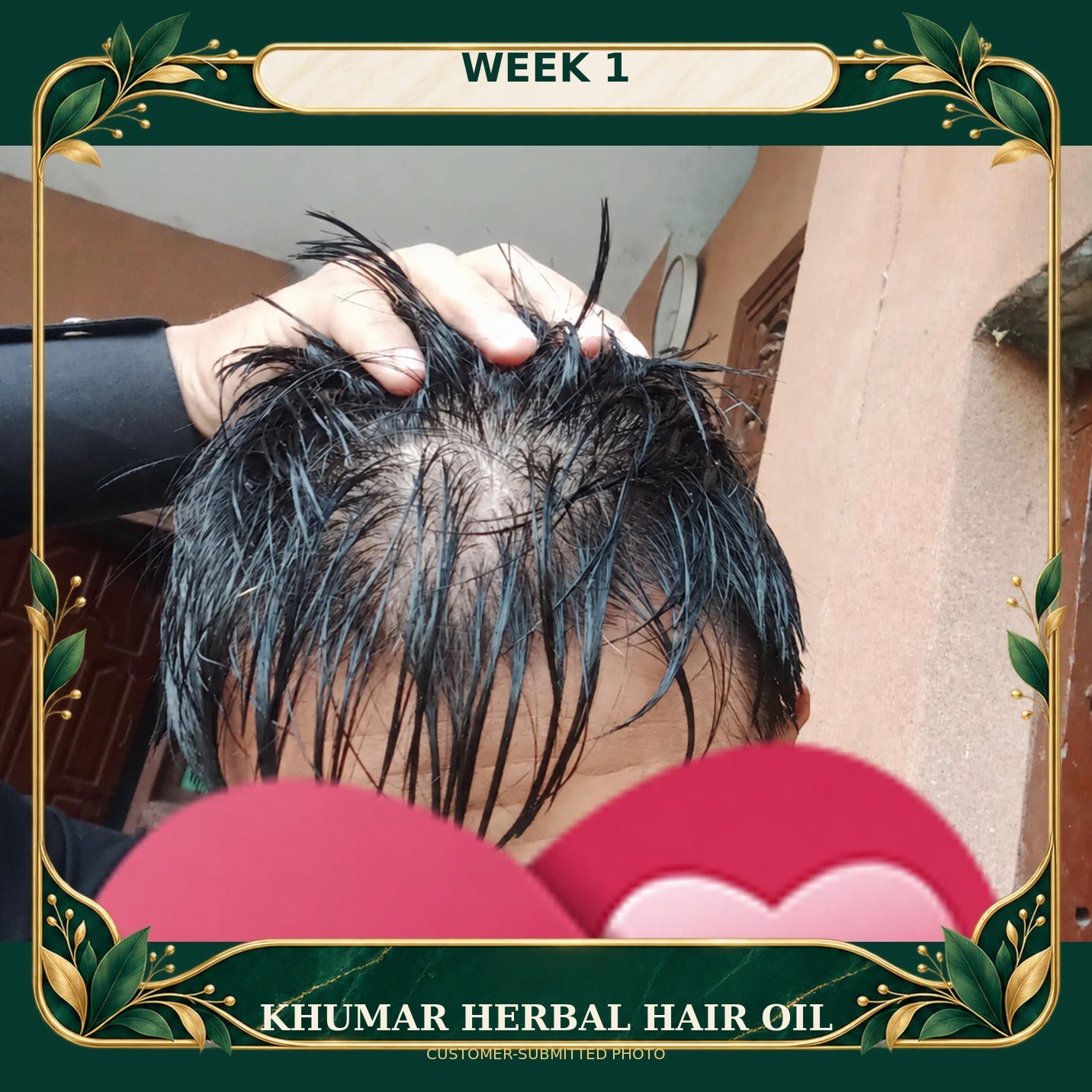 Customer-submitted Khumar Herbal Hair Oil result at Week 1