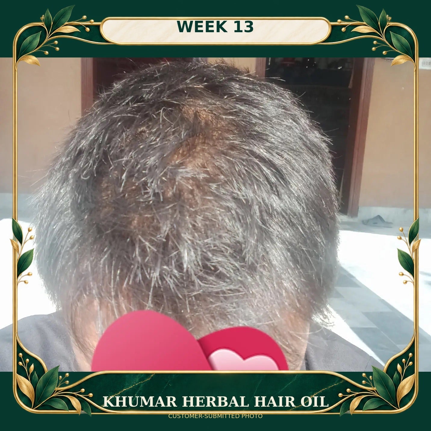 Customer-submitted Khumar Herbal Hair Oil result at Week 13