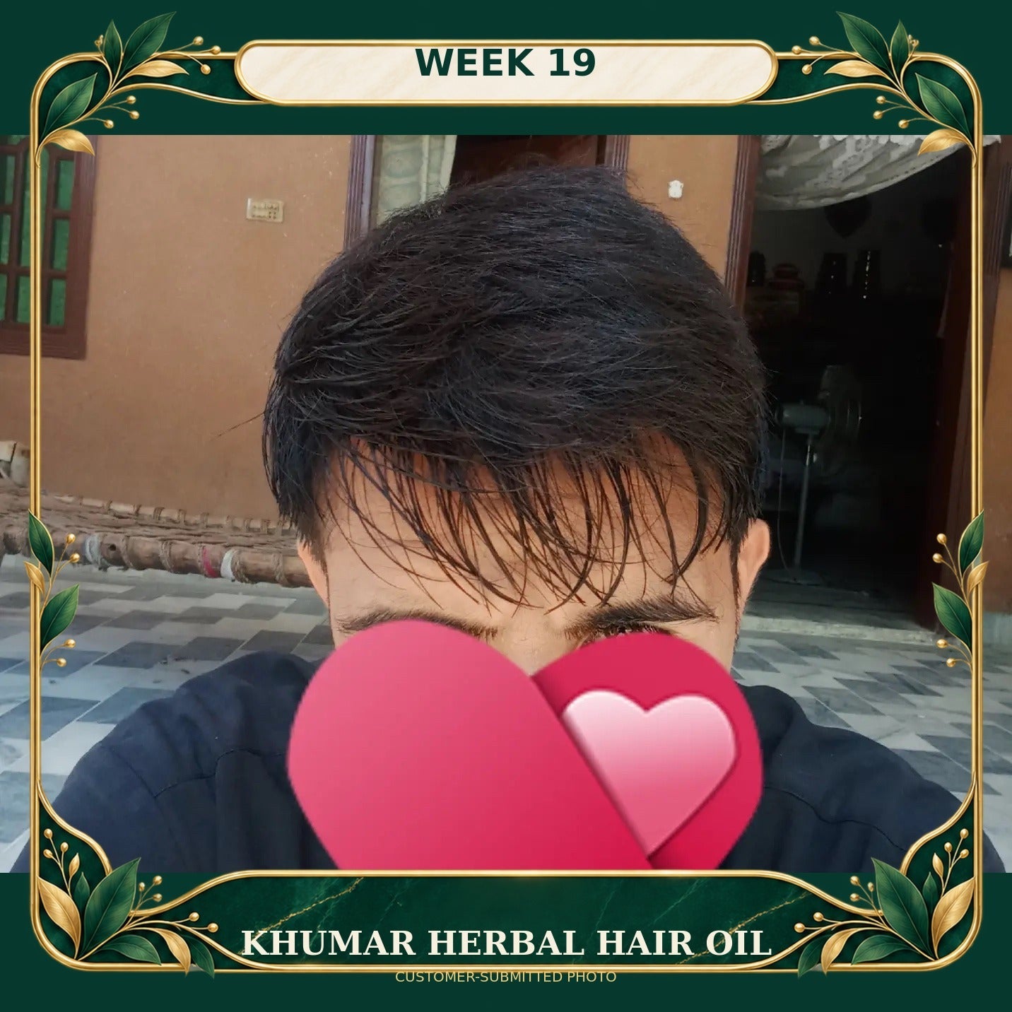 Customer-submitted Khumar Herbal Hair Oil result at Week 19