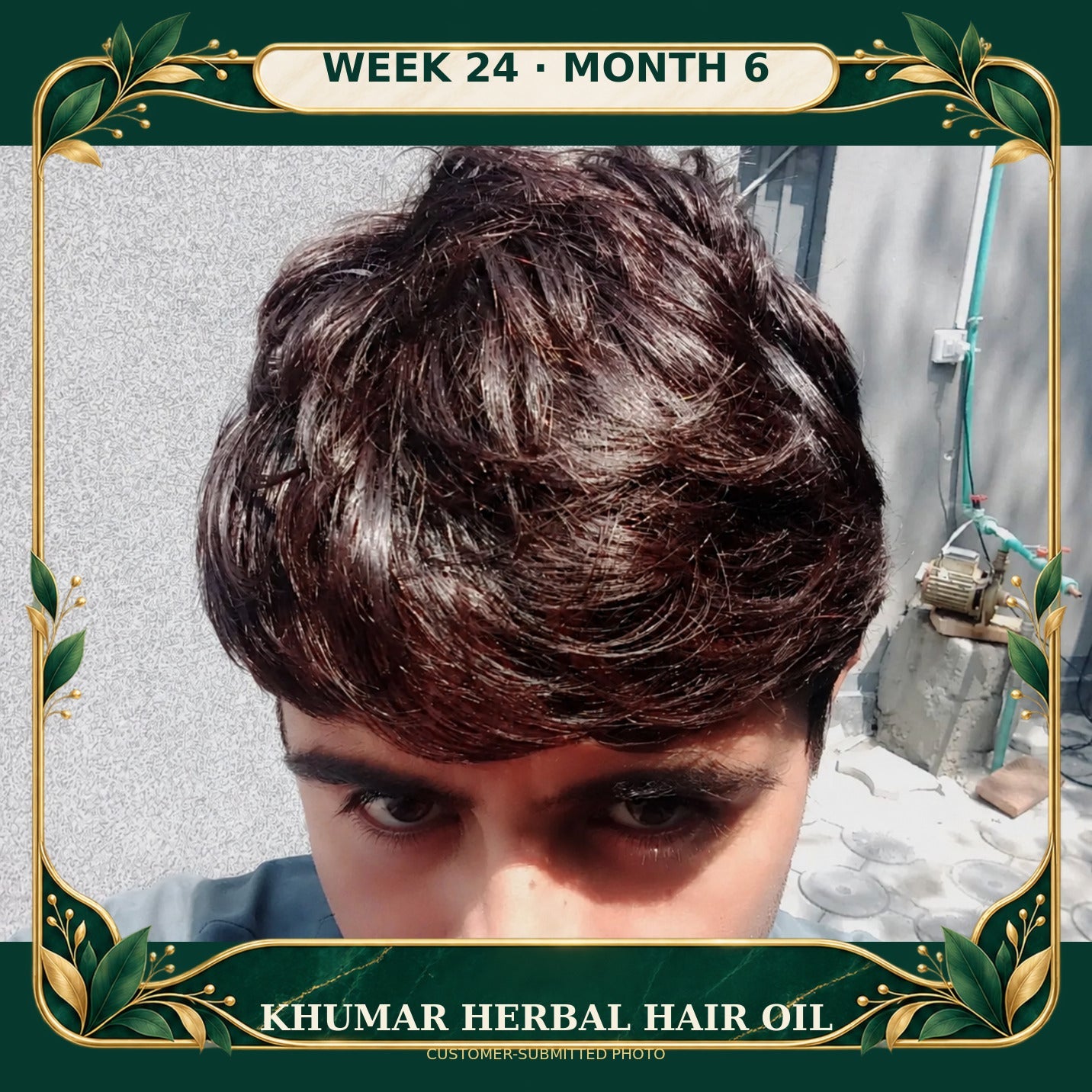 Customer-submitted Khumar Herbal Hair Oil result at Month 6