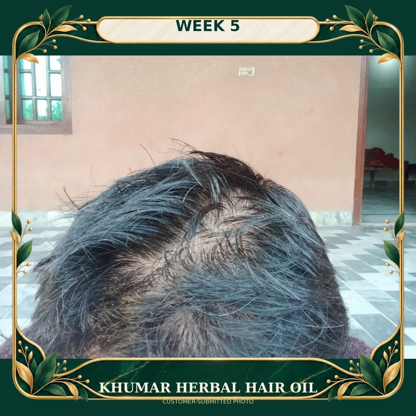 Customer-submitted Khumar Herbal Hair Oil result at Week 5