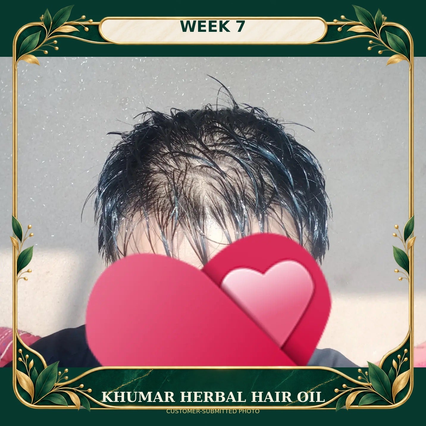 Customer-submitted Khumar Herbal Hair Oil result at Week 7