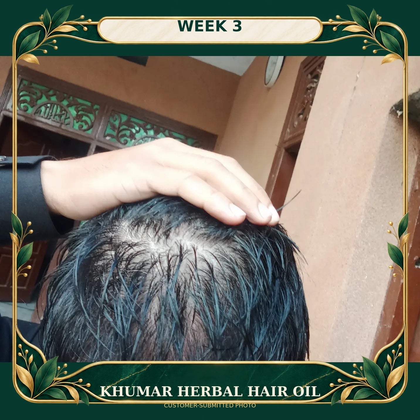Customer-submitted Khumar Herbal Hair Oil result at Week 3