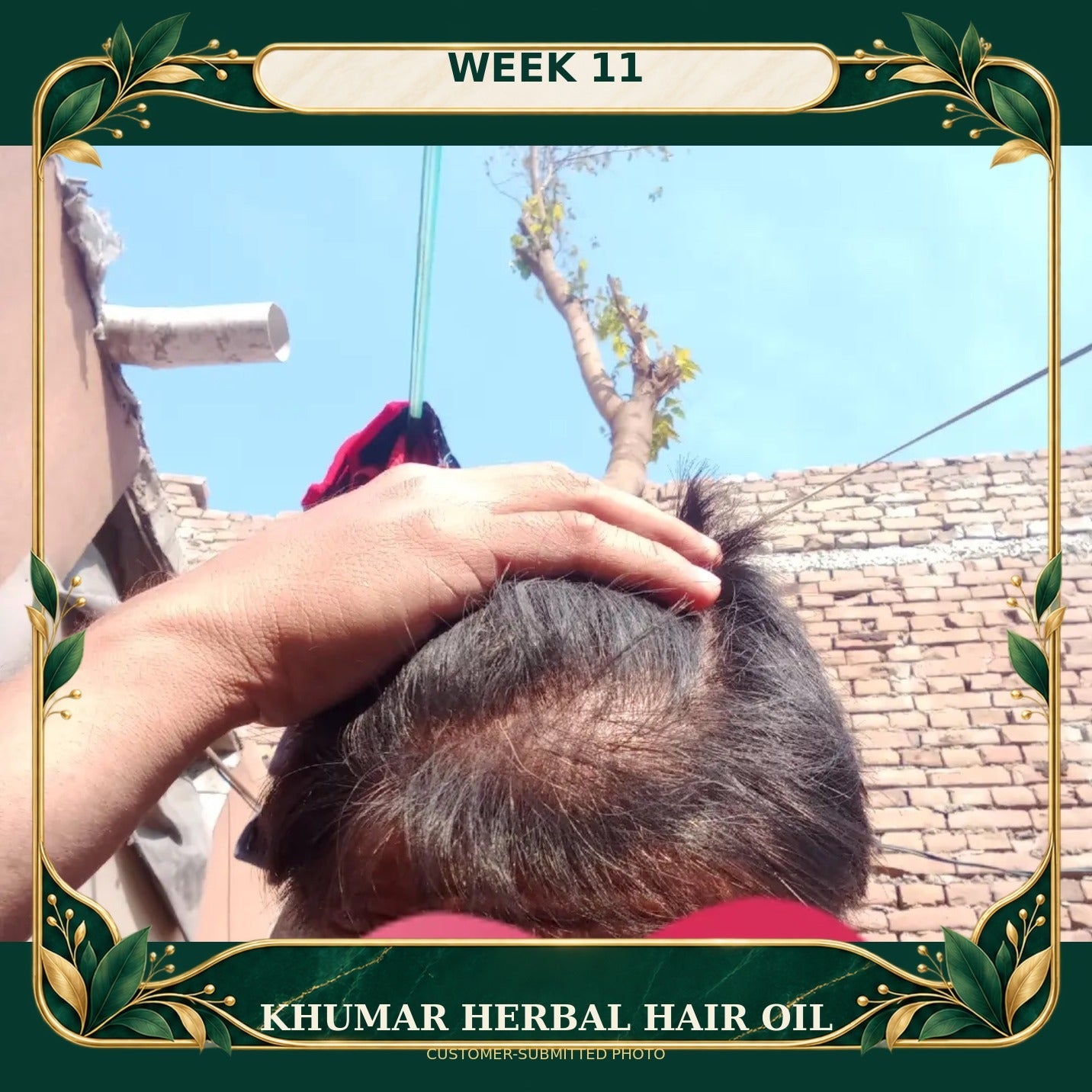 Customer-submitted Khumar Herbal Hair Oil result at Week 11