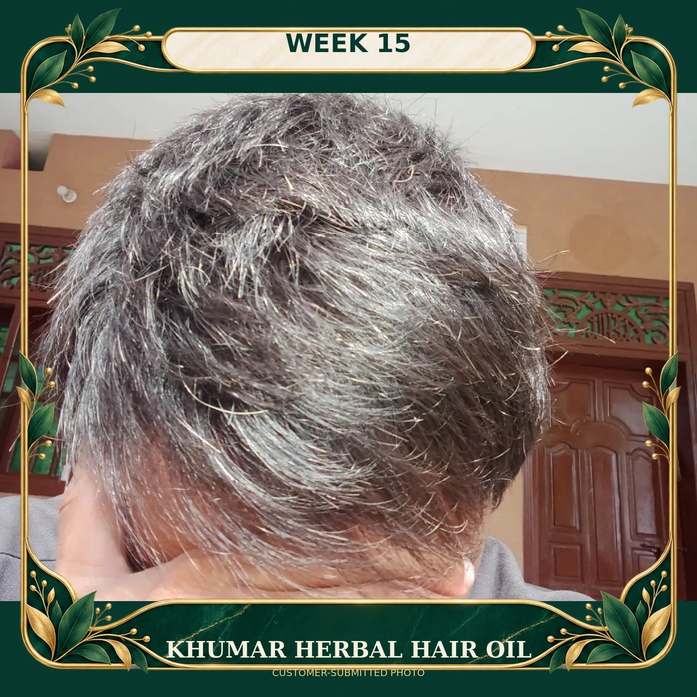 Customer-submitted Khumar Herbal Hair Oil result at Week 15