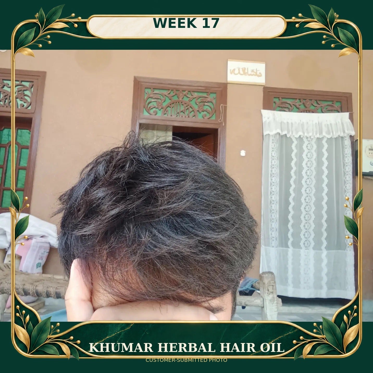 Customer-submitted Khumar Herbal Hair Oil result at Week 17