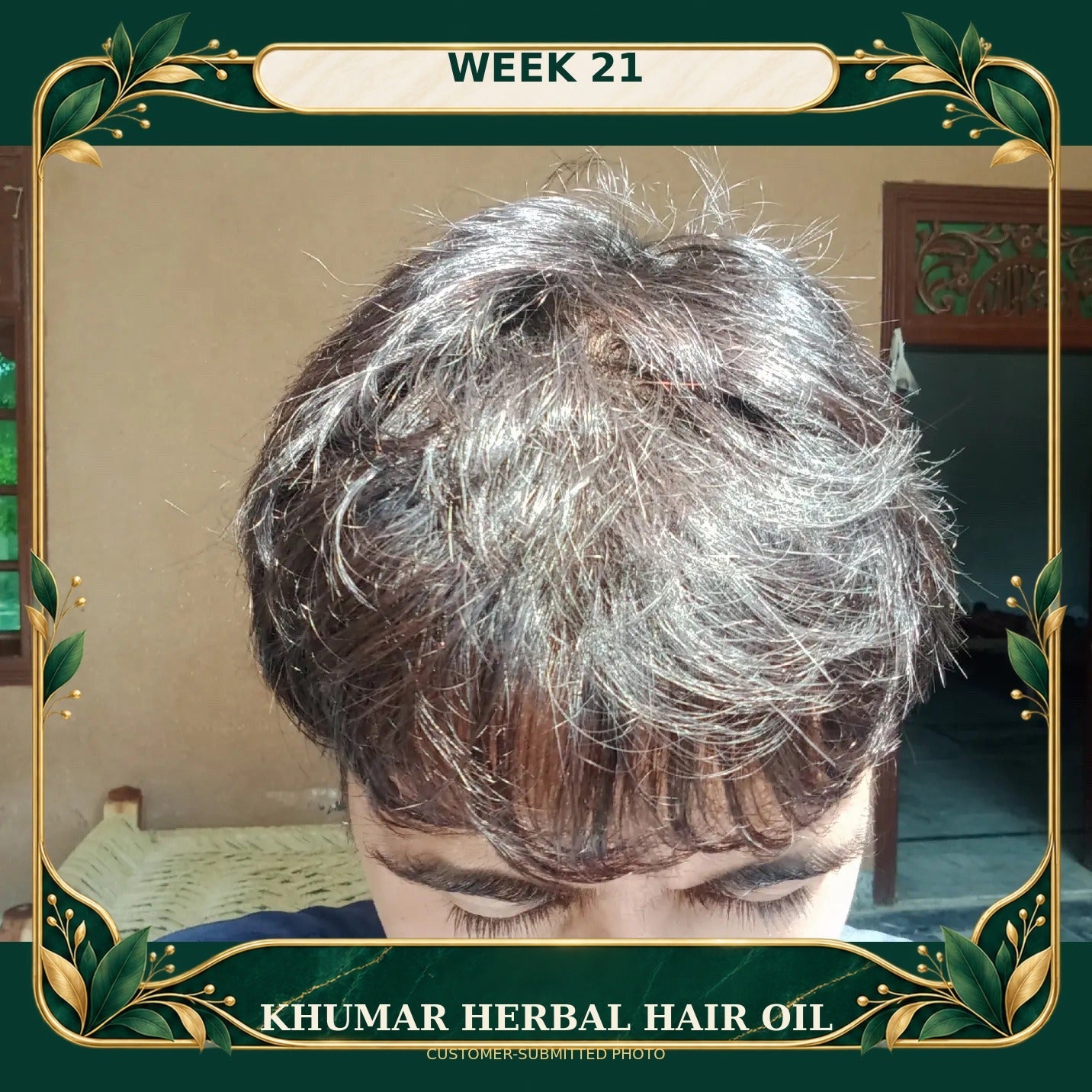 Customer-submitted Khumar Herbal Hair Oil result at Week 21